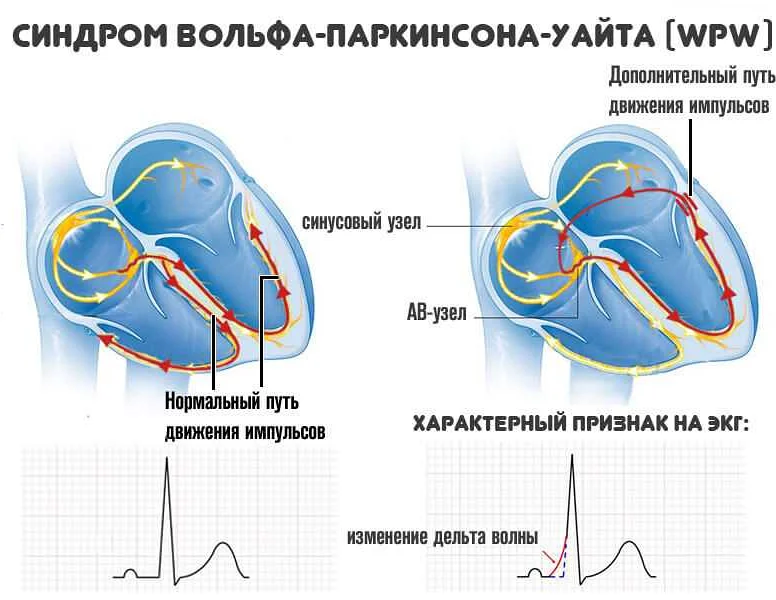 Как выбрать VPS 30 для своего бизнеса